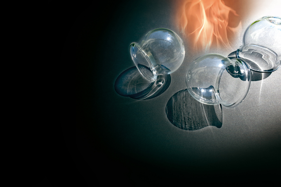 André Lindwedel Schröpfgläser